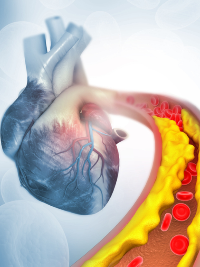 avoid food for high cholestrol