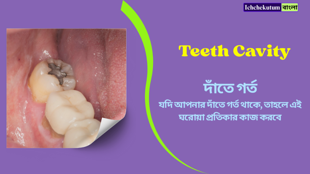 Teeth Cavity